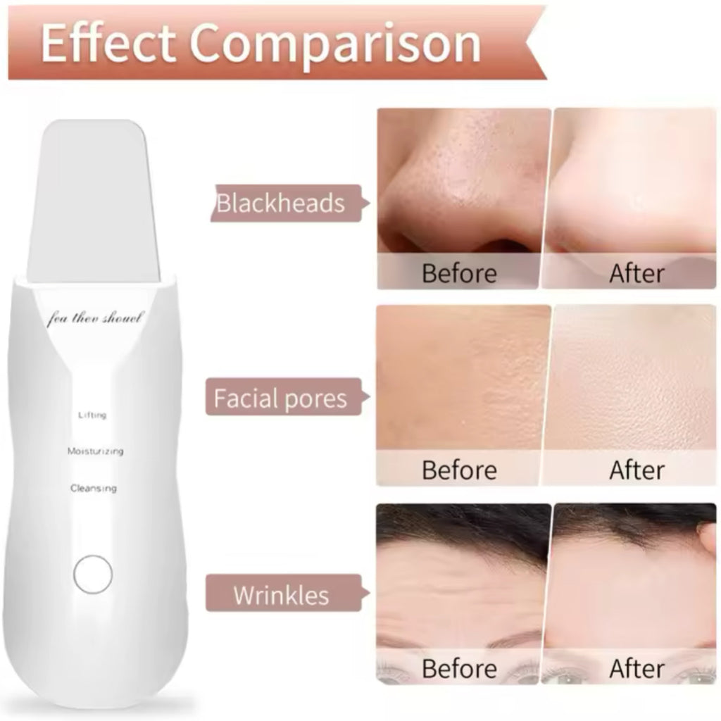 Elektrisk Hudskrubber – Glattere hud. Sunnere glød.